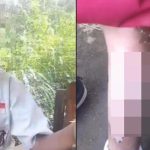 Bocah Jember Disiram Kuah Bakso Panas, Kekerasan Terungkap